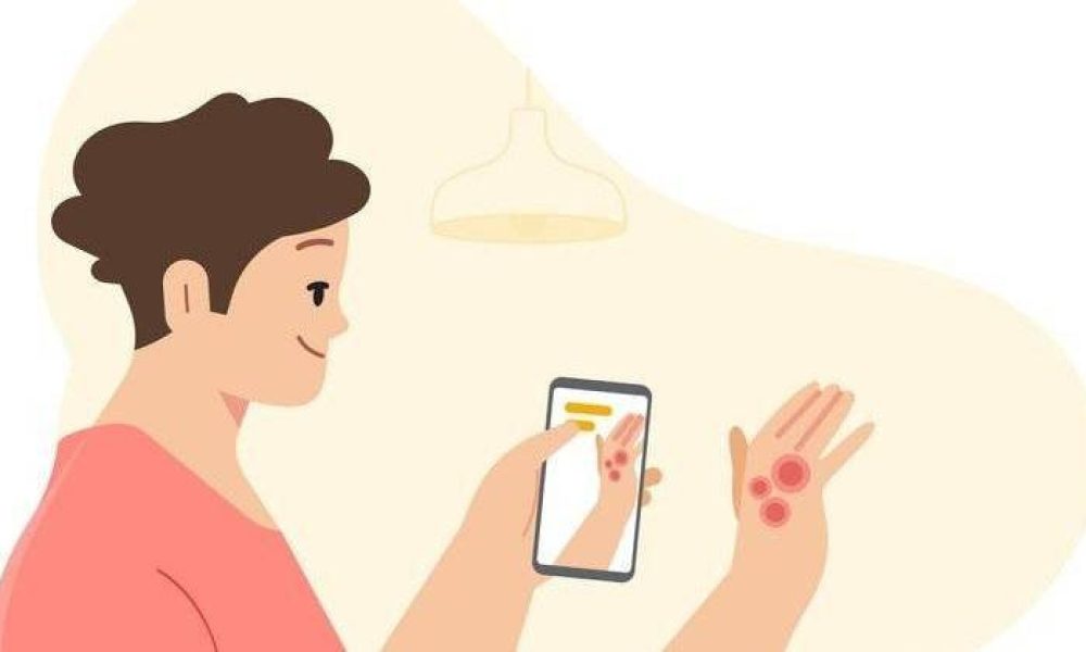 Google представил приложение для обнаружения заболеваний кожи