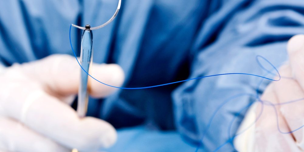 Уральское предприятие расширит производство хирургических нитей в пять раз